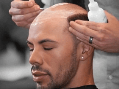 hair wig fixing